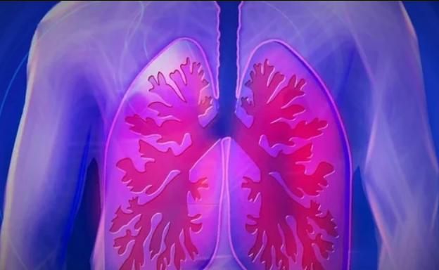 Lung Disease COPD