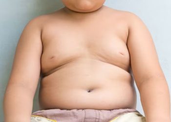 बच्चों के मोटापे