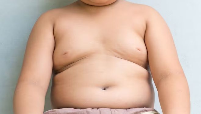 बच्चों के मोटापे