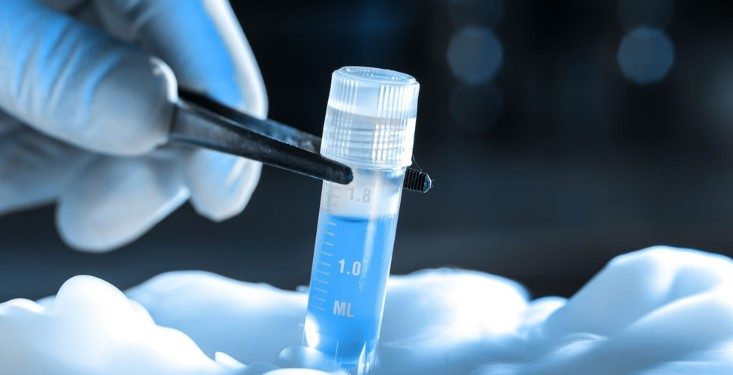 Sperm will be prepared in the lab