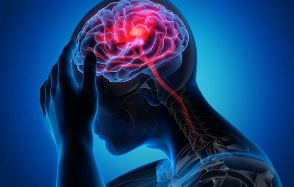 brain hemorrhage