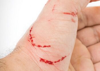 मानव रेबीज