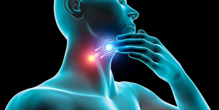 head and neck cancer