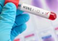 Swine flu hits Delhi
